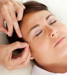 acupunctureincashe; acupunctureincashe;
